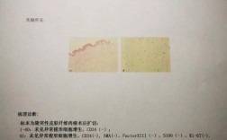 河北中医学院考博病理