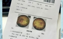 青岛大学眼科考博考哪些科目？