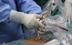 首都医科大学内镜考博有何独特之处？