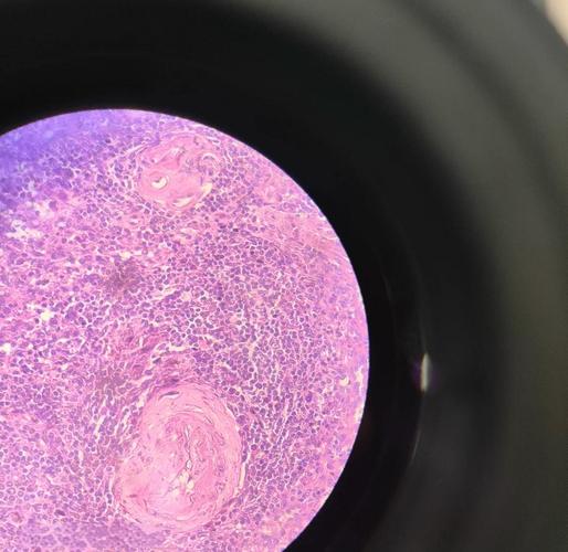 昆明医科大学考博病理学难度如何？-图3