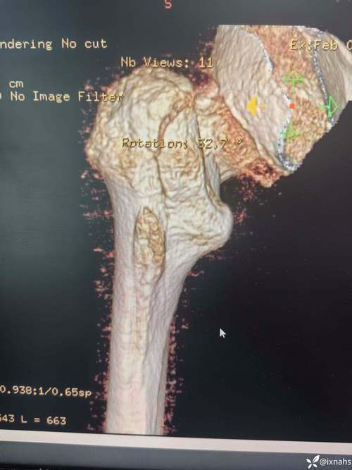 浙大骨科考博真题难度如何？-图3