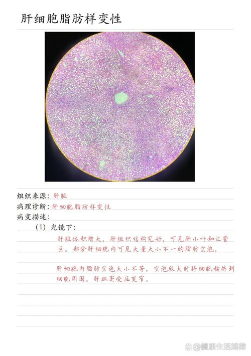 山西医科大学考博病理-图2