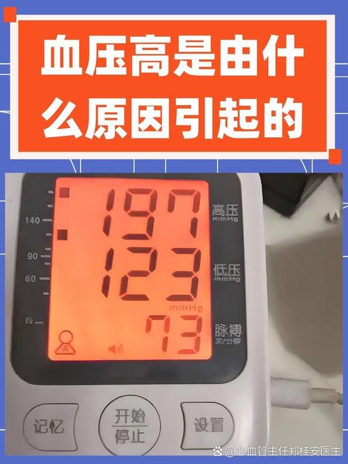 考博体检血压高会影响录取吗?-图1 考博体检血压高会影响录取吗?-图1