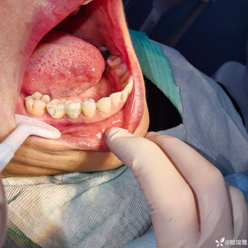 中山口腔考博真题难度如何？-图2